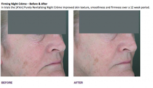 Before and After A'Kin Revitalising Night Creme